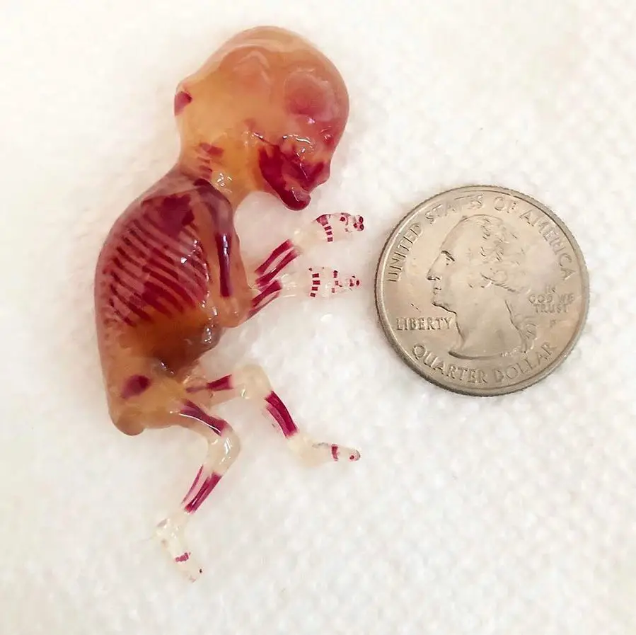 11 week old fetus  MediHelp