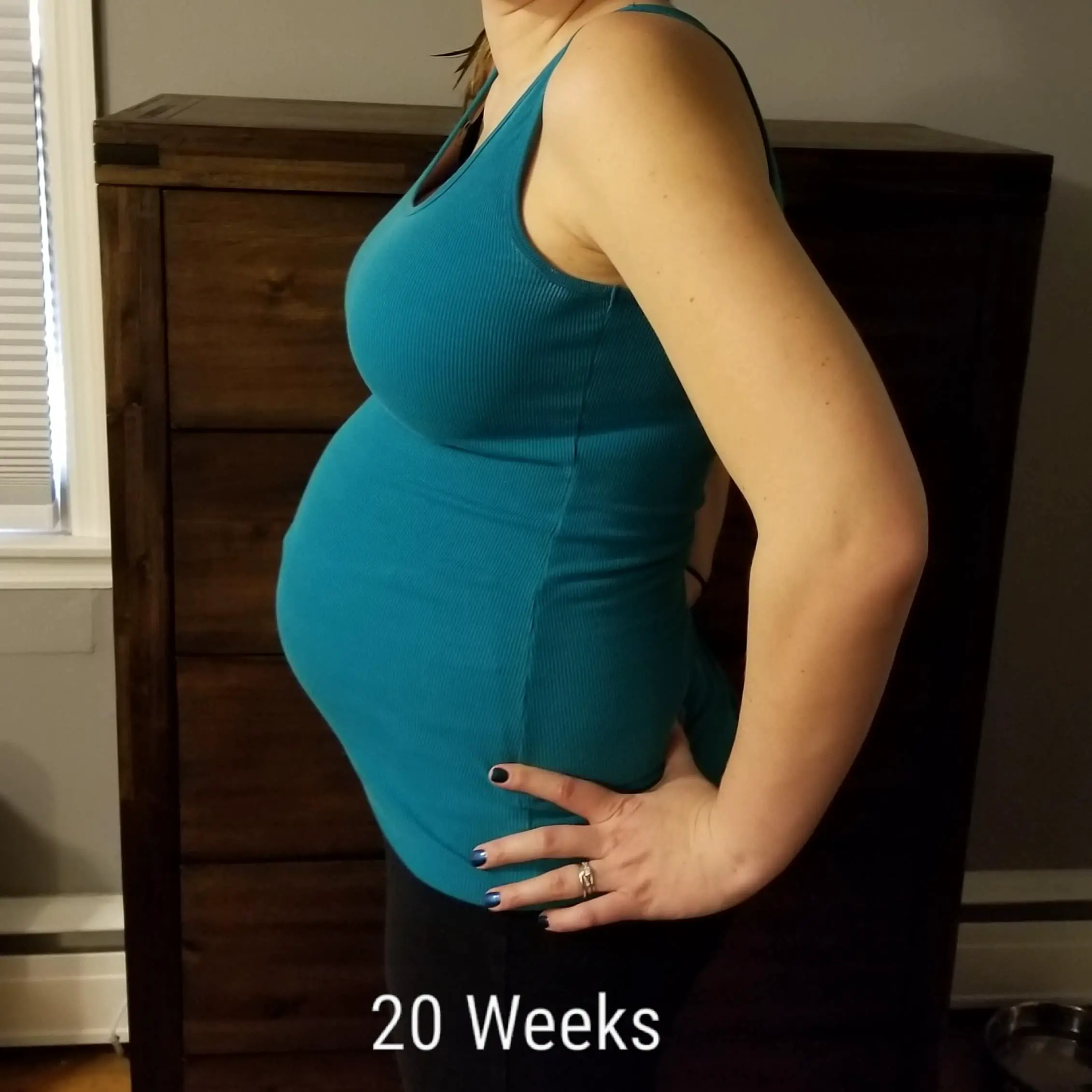 20 Weeks Pregnant with Twins: Tips, Advice &  How to Prep