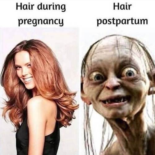 7 Tips to Prevent Pregnancy Hair Loss and Postpartum Thinning