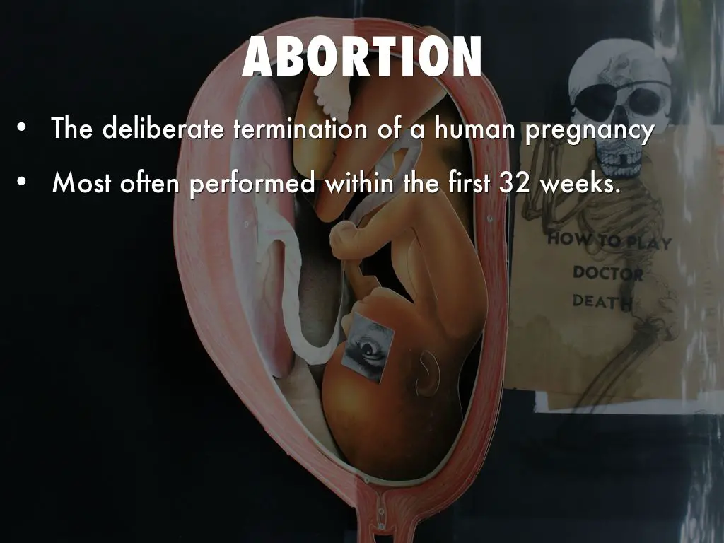 Abortion by annaorsborn