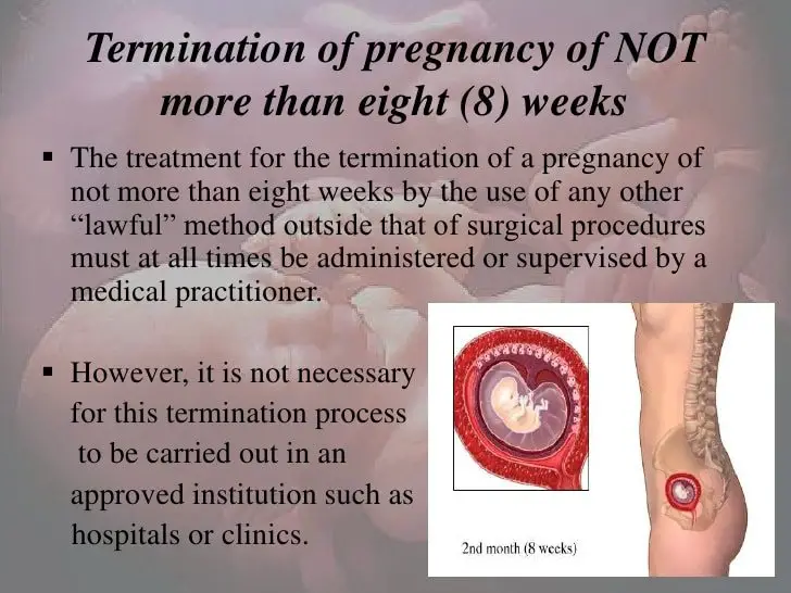 abortion termination of pregnancy
