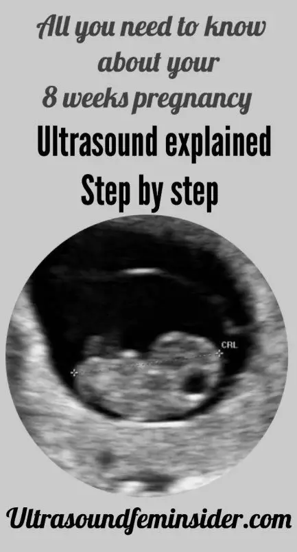All about normal 8 week ultrasound.