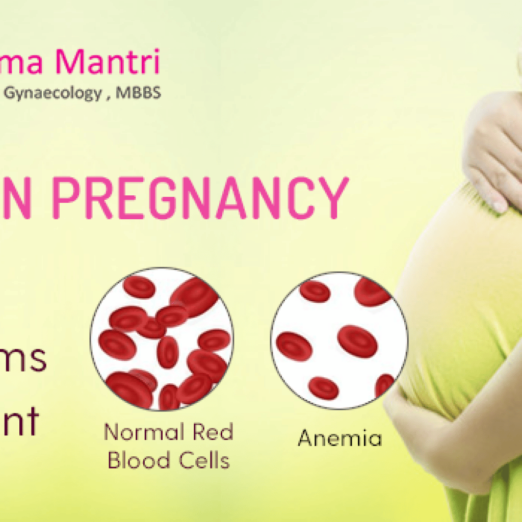 anemia in pregnancy â causes, symptoms, and treatment