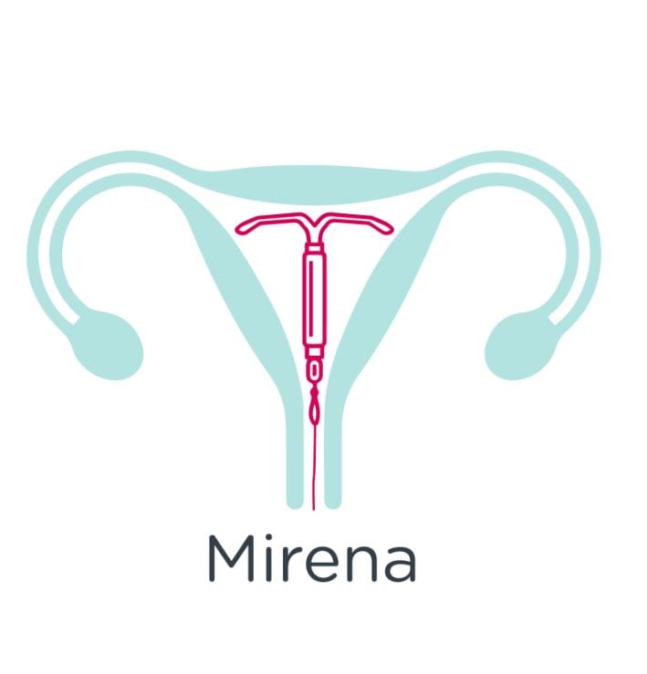 Birth control with a Mirena