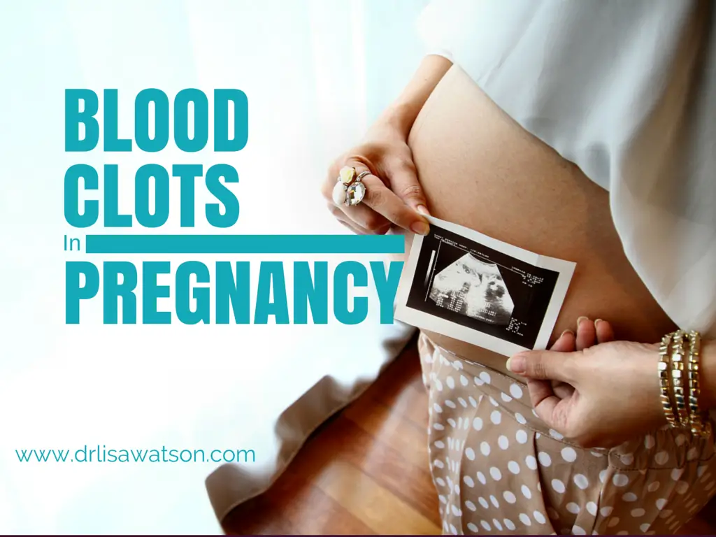 Blood Clots in Pregnancy