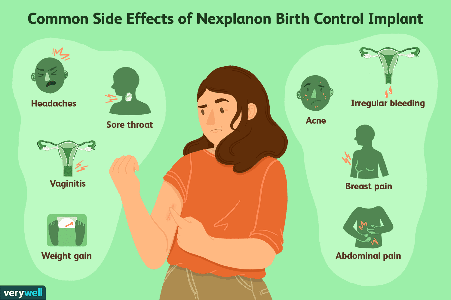 Can You Get Pregnant If Nexplanon Expires