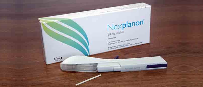 How Soon Can I Get Pregnant After Nexplanon Removal - PregnancyProTips.com