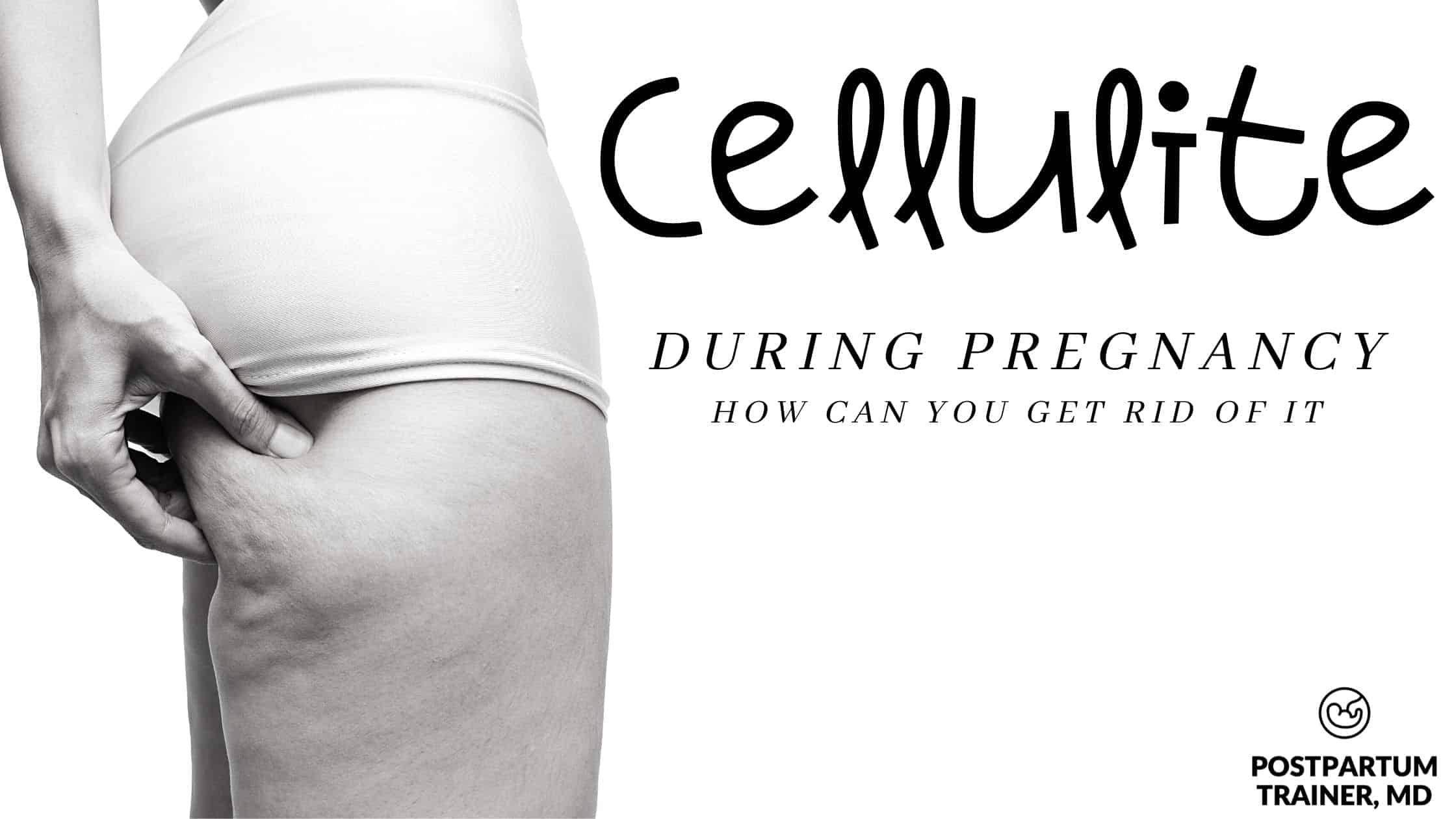 Cellulite During Pregnancy [Everything You Need To Know]