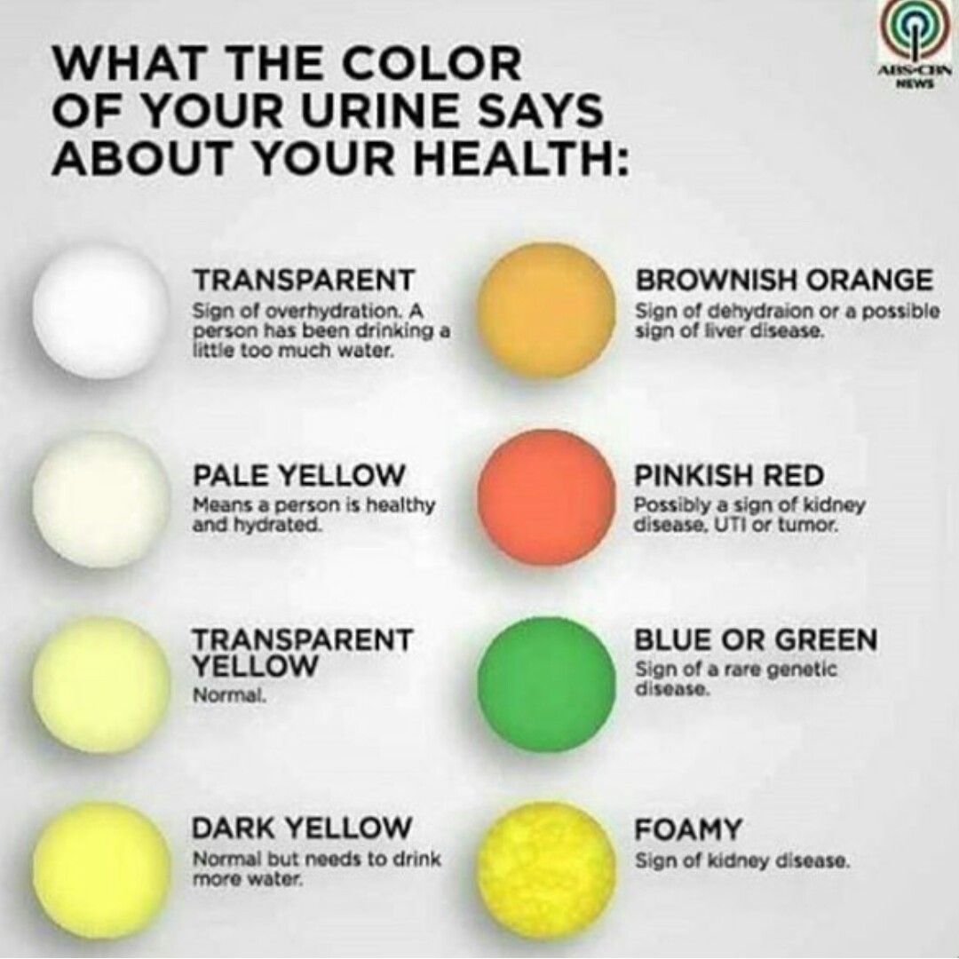Color of urine by JusaintRite on I need help...