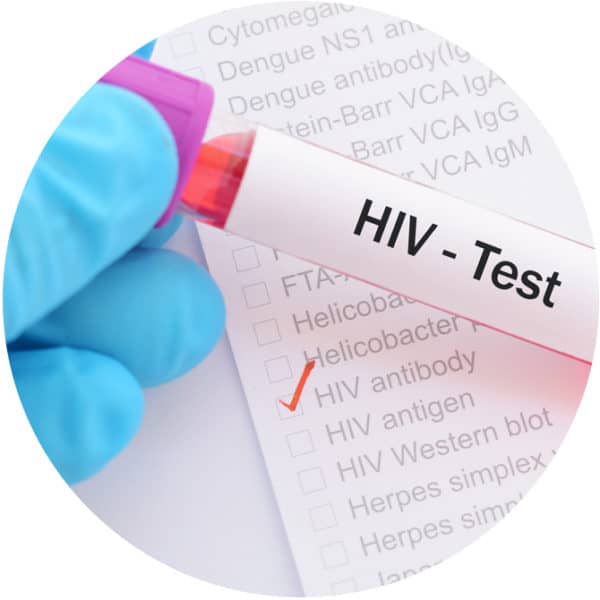 Does Medicare Cover Hiv Testing