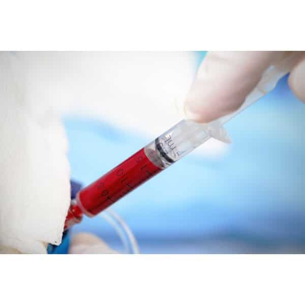 Does Pregnancy Blood Work Test For Stds