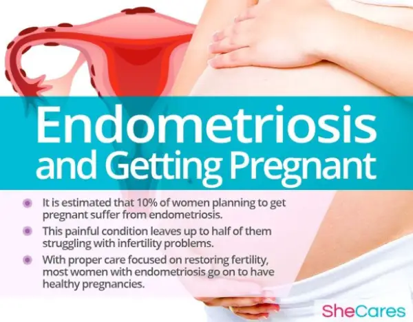 Endometriosis and Getting Pregnant: What You Need to Know ...