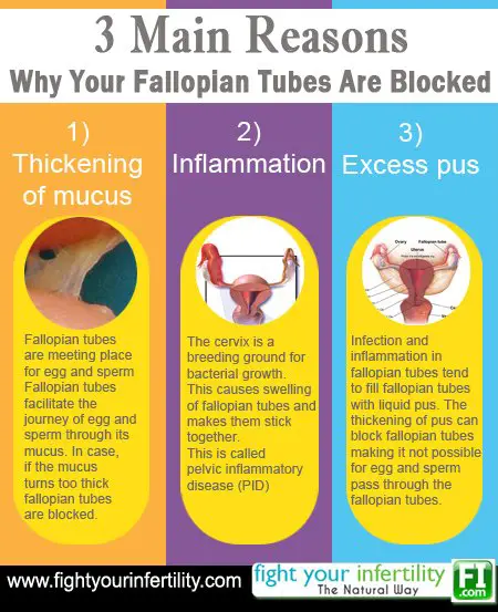 Energy Exercises To Open Blocked Fallopian Tubes Naturally