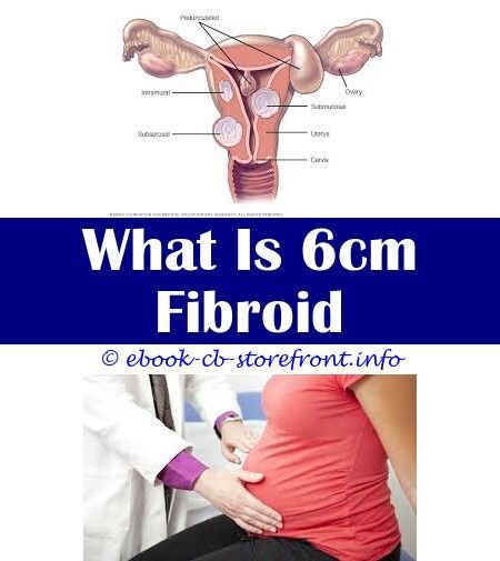 Fibroids Cause Indigestion