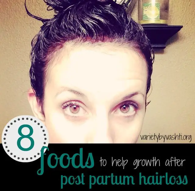 Foods to Eat for Post Pregnancy Hair Growth