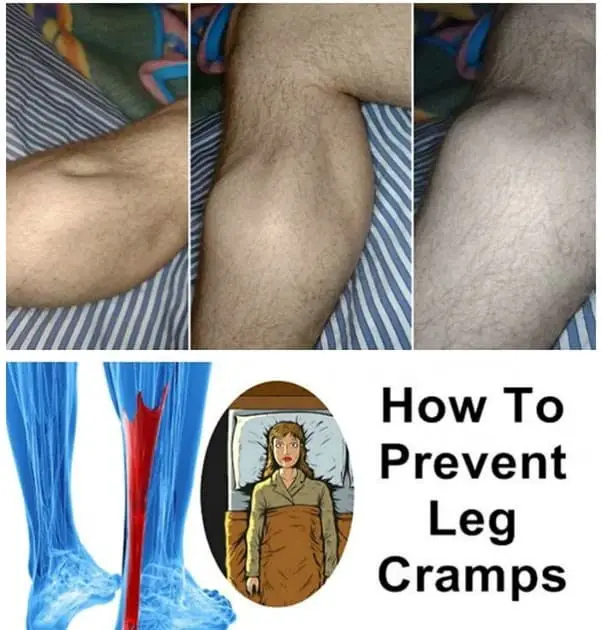 Foot And Leg Cramps Pregnancy Mention To Doctor ~ ericuhlirdesign