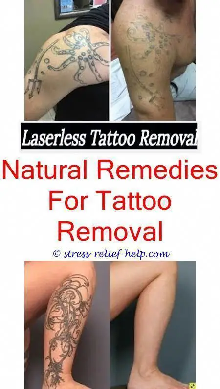 Future of tattoo removal.Can you get a tattoo removed ...
