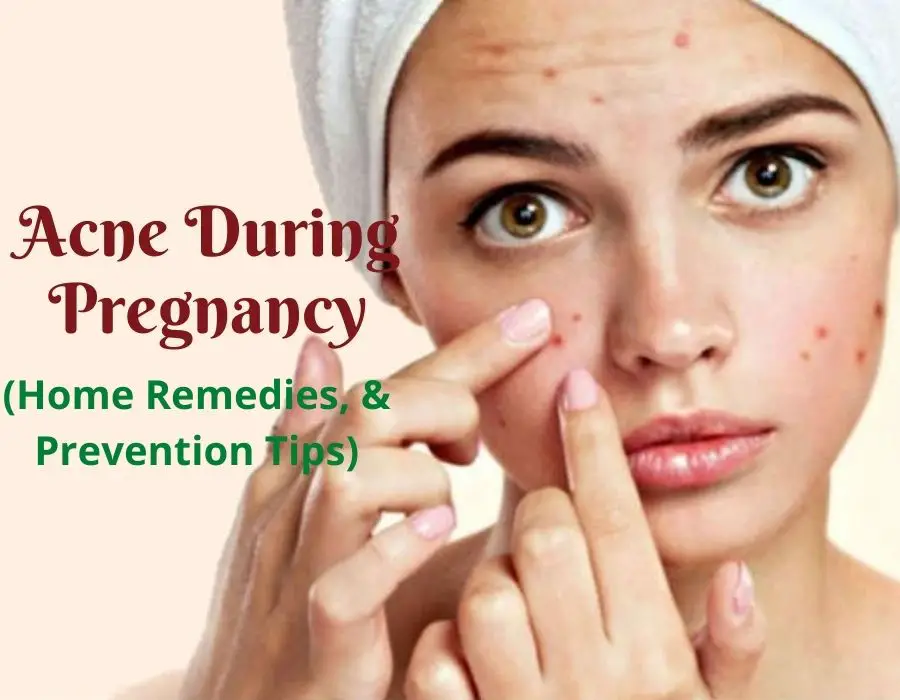 Get Rid Of Acne During Early Pregnancy Home Remedies ...