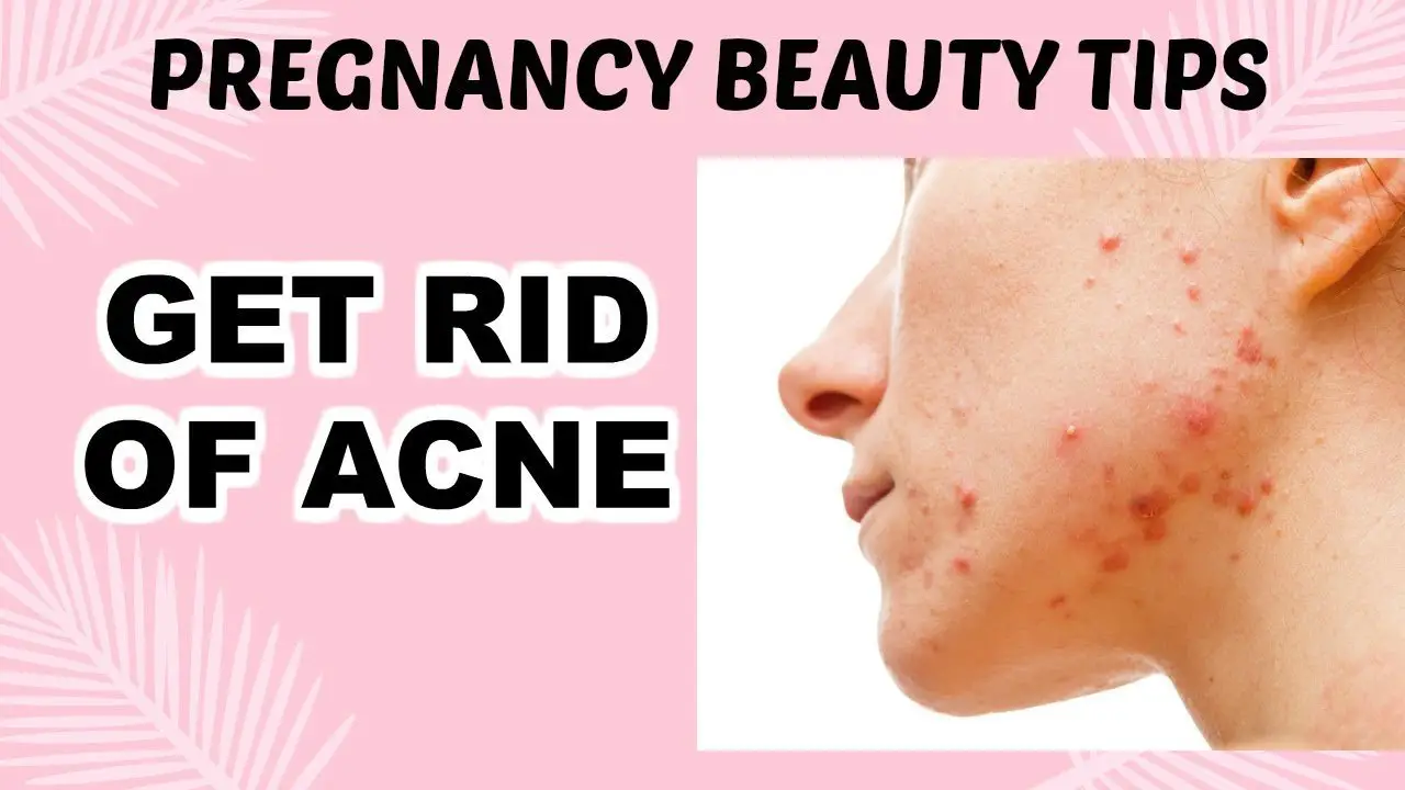 GET RID OF ACNE