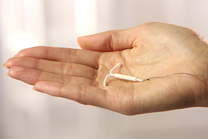 Getting Pregnant After Mirena (IUD) Removal: Everything You Need To Know