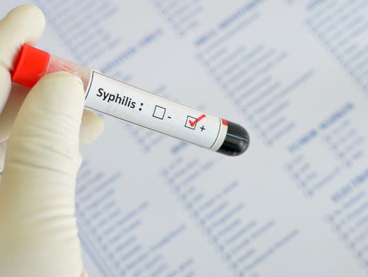 Health department urges syphilis testing for pregnant women