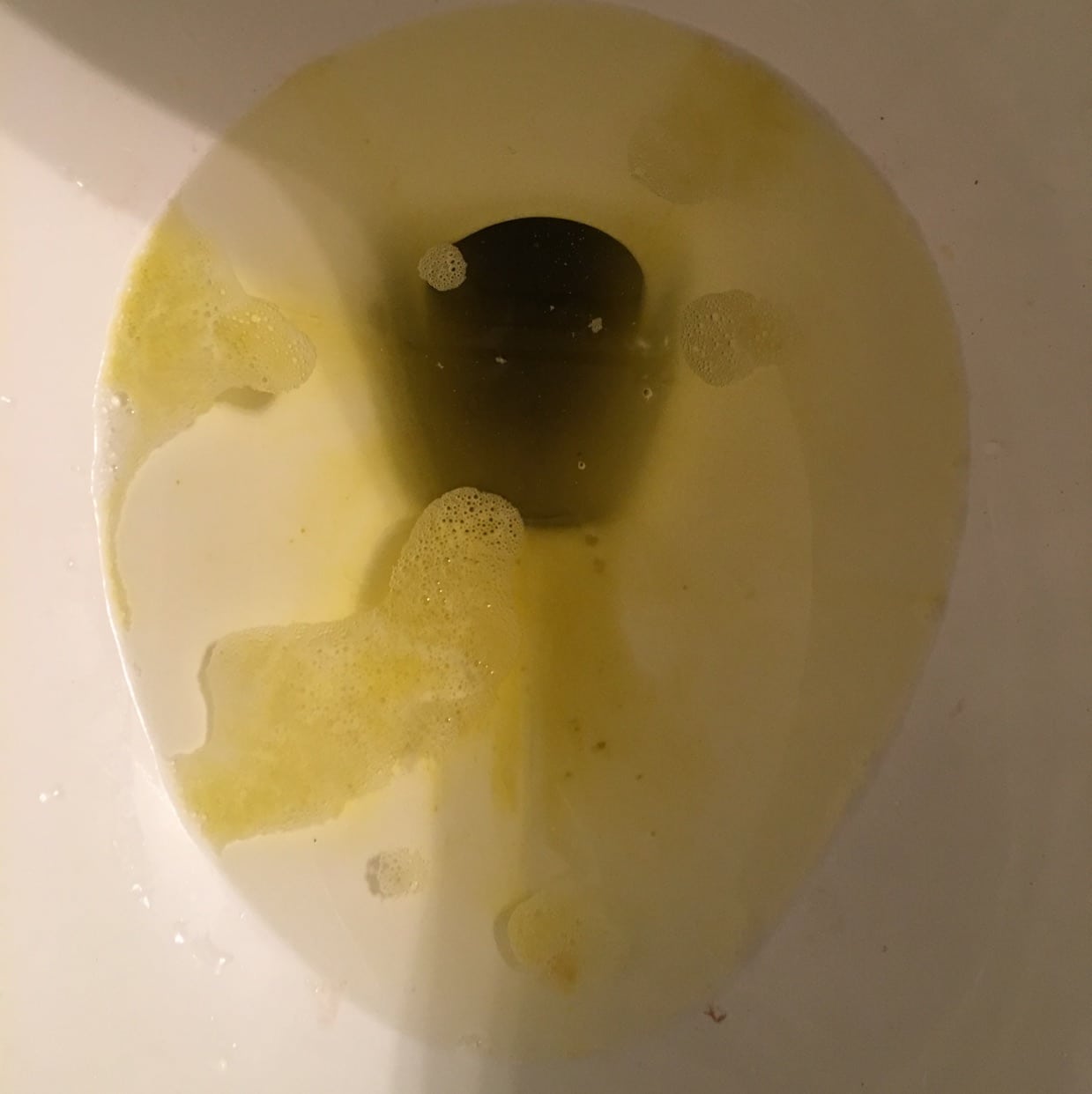 Help!! Been throwing up straight yellow bile for hours now and my last ...