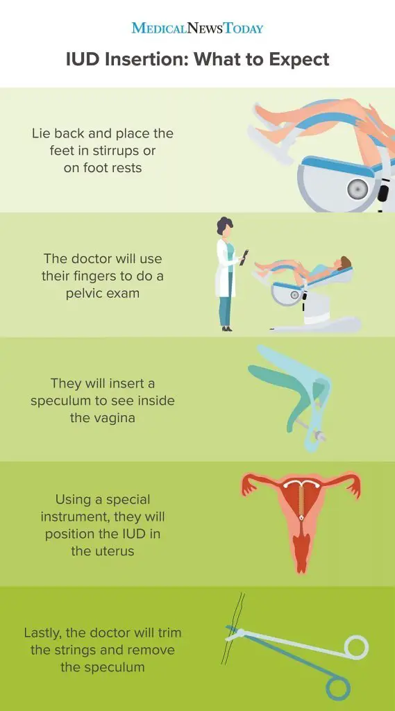 How Common Is Getting Pregnant With An Iud