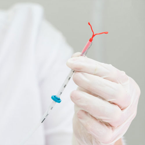 How do IUDs help in birth control?