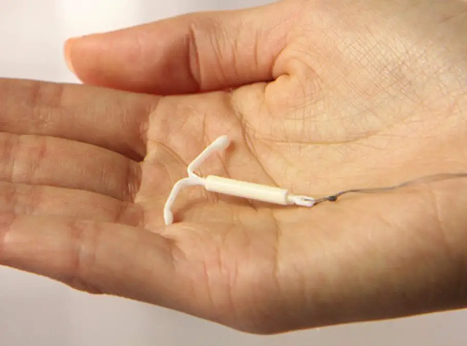 How Soon Can You Get Pregnant After Having Your IUD Removed?