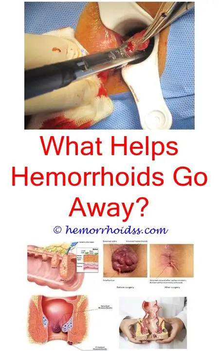 How To Get Relief From Hemorrhoids During Pregnancy ...