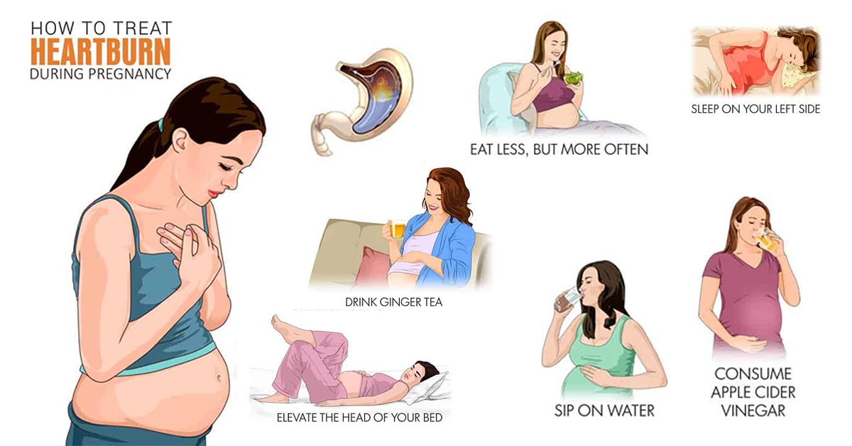 How to get rid of heartburn when pregnant naturally