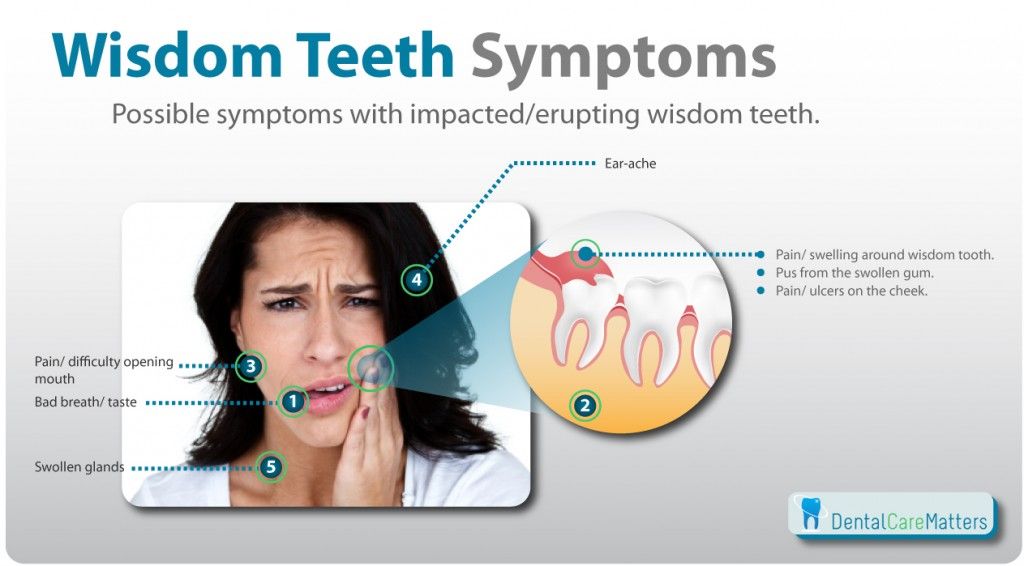 How To Get Rid Of Wisdom Tooth Pain While Pregnant ...