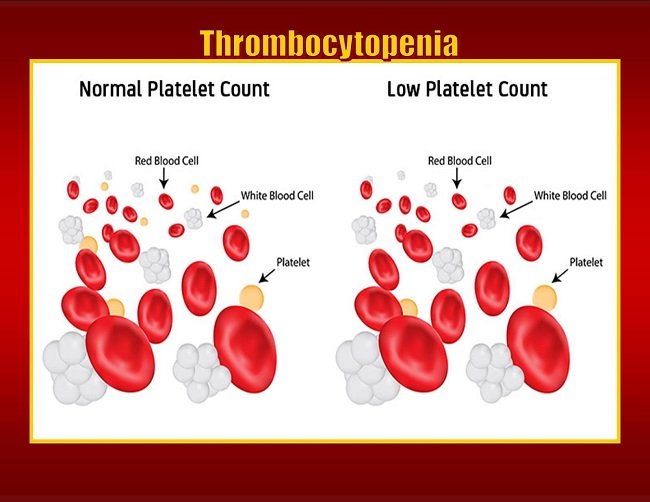 How To Increase Your Platelet Count Naturally For Better Health