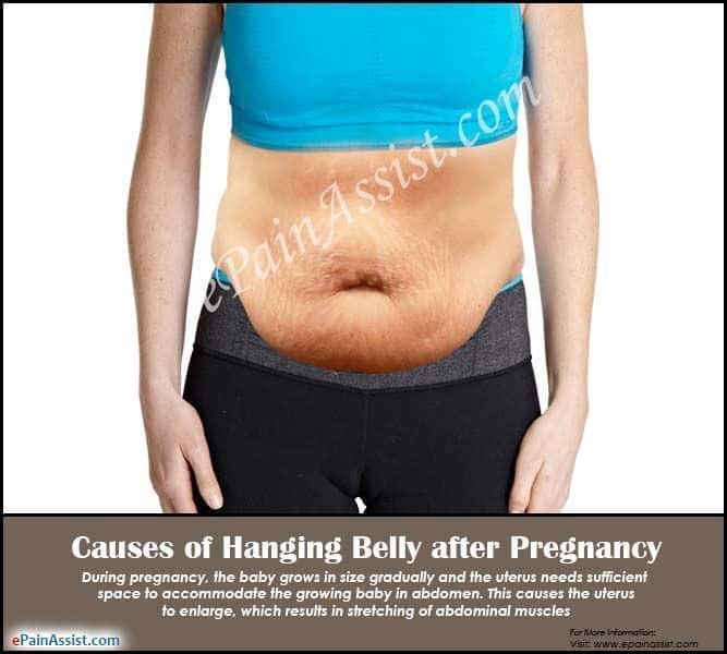 How To Lose Belly Fat During Pregnancy