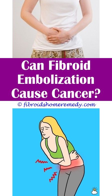 How To Prevent Fibroids