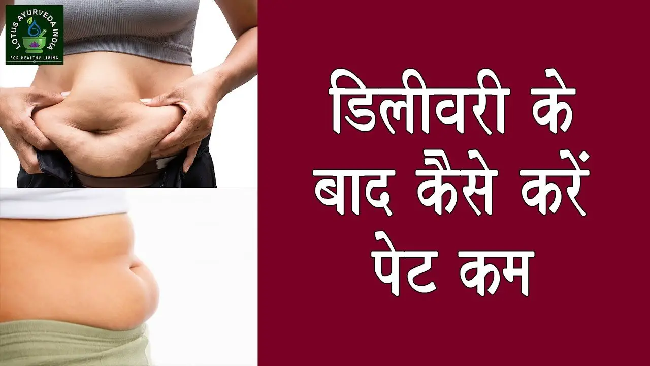 How to Reduce Belly Fat after Pregnancy