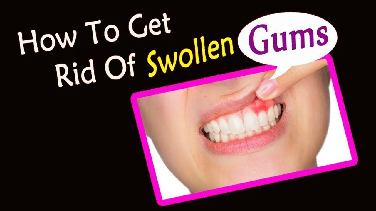 How Treat Swollen Gums Naturally at Home
