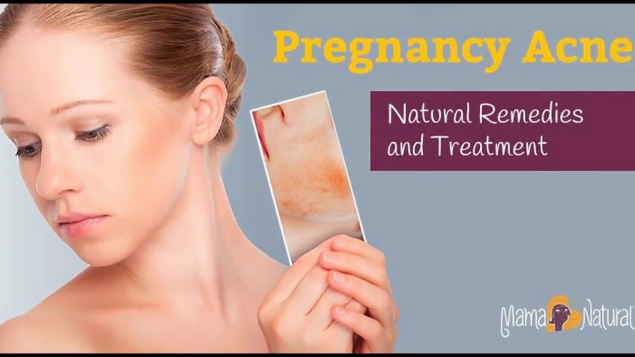 Important ! cause pregnancy acne you must know before too ...