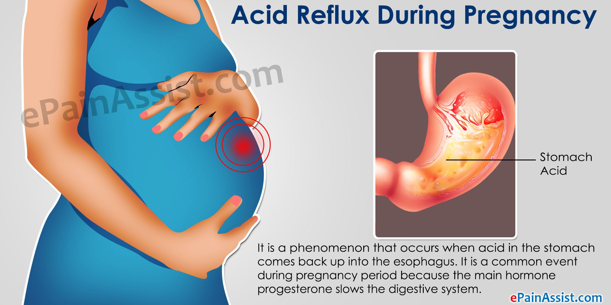 Indigestion And Reflux Causes Pregnancy Early During ...