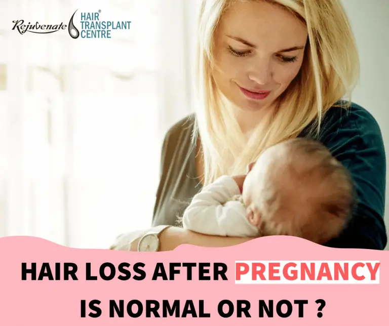 Is Hair Loss After Pregnancy Normal?