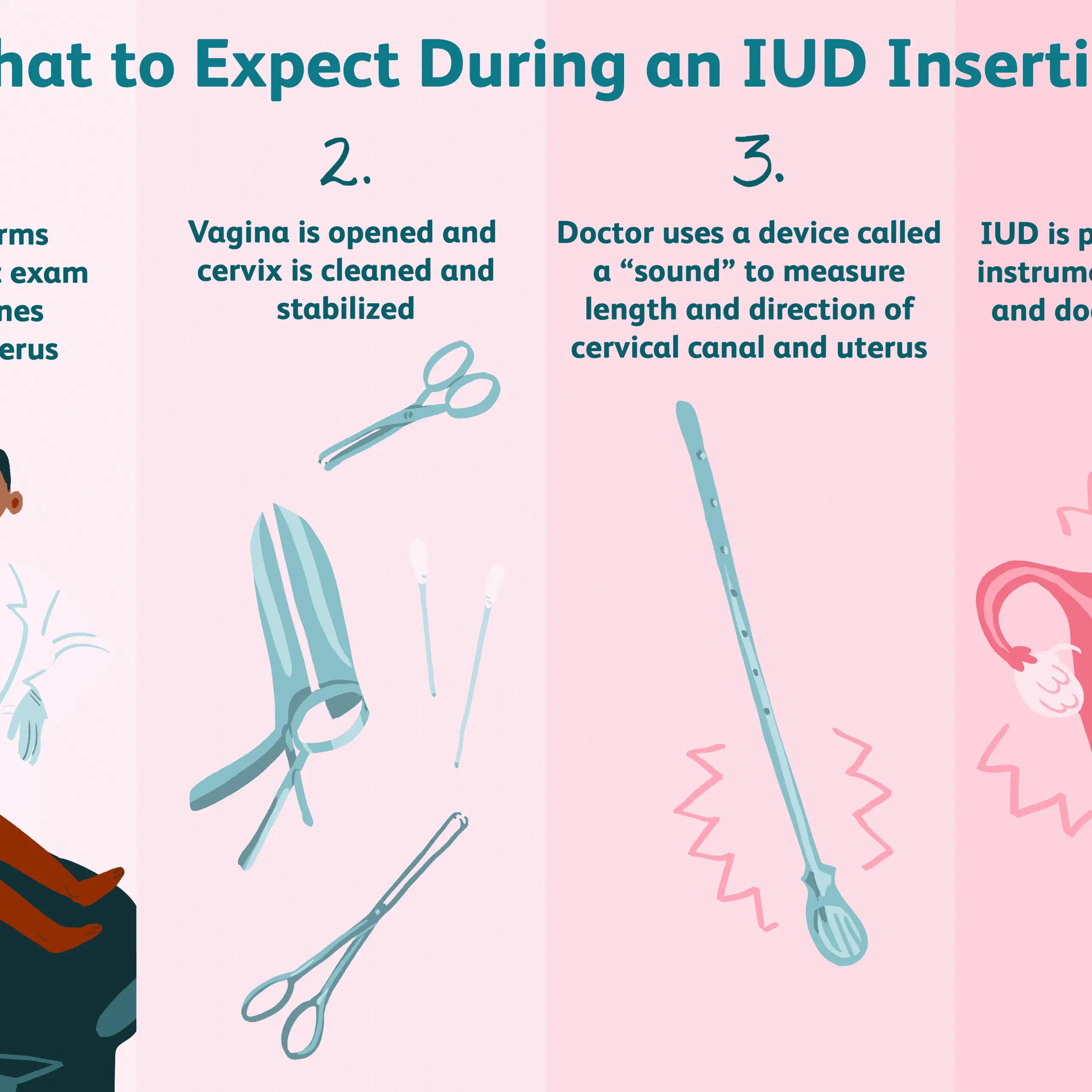 Iud Insertion Device : Intrauterine Contraception Hormonal Iud Copper ...