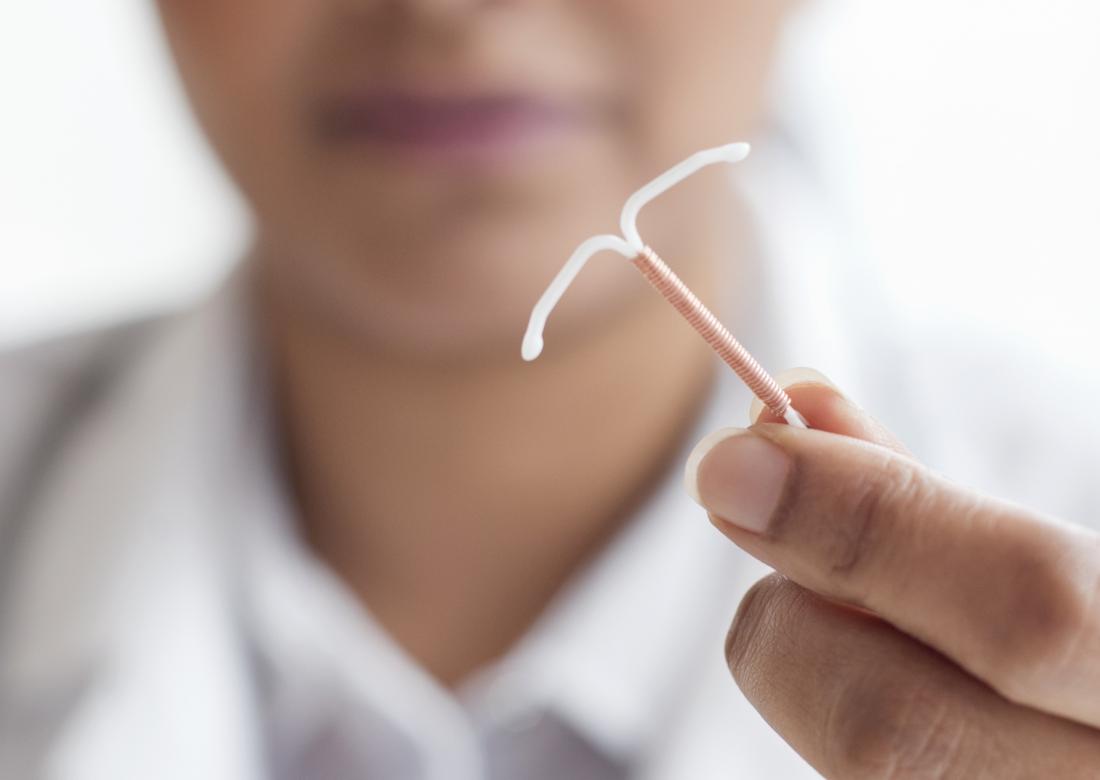 IUD removal: When to remove an IUD and what to expect