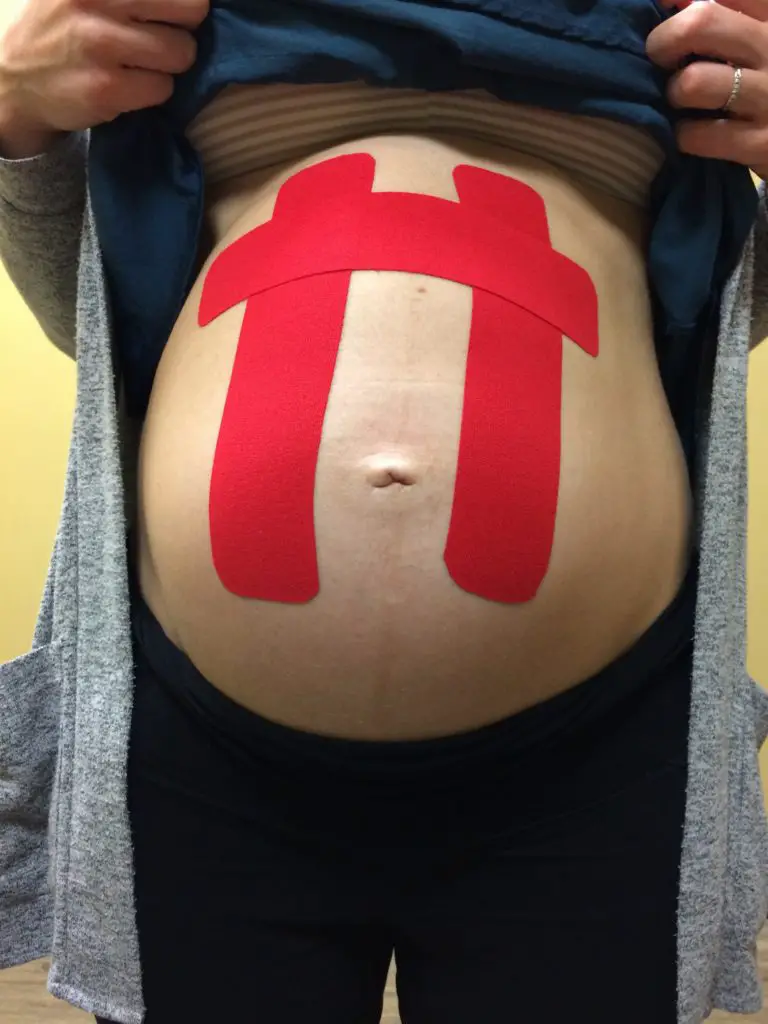 Kinesiology Tape During Pregnancy