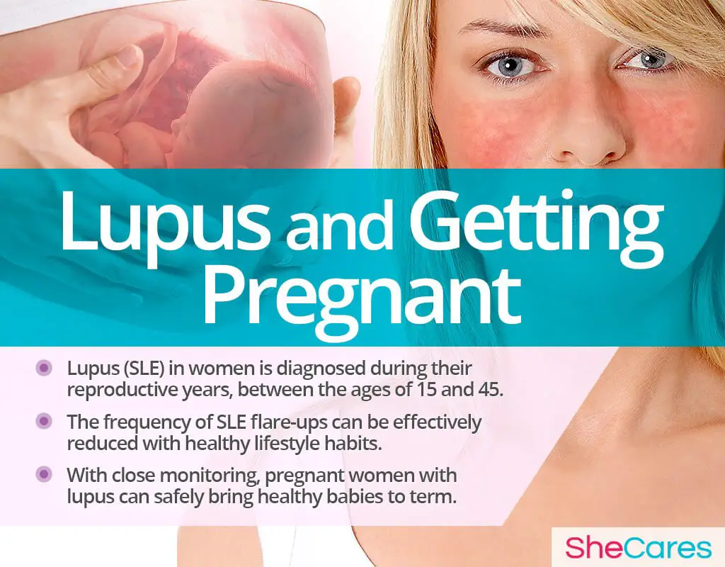Lupus and Getting Pregnant