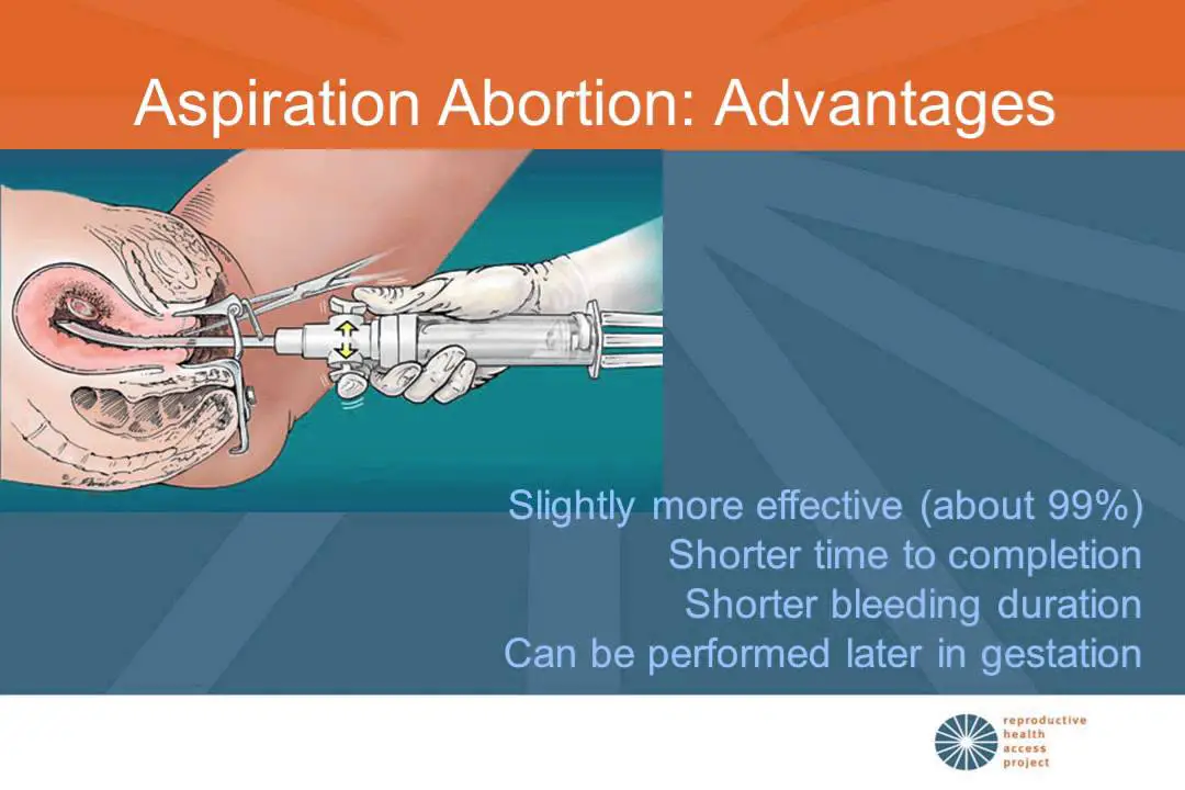 Medication Abortion In Early Pregnancy