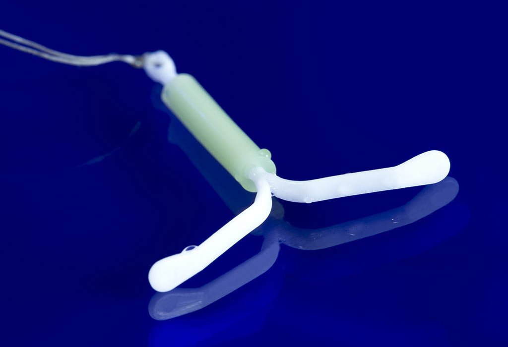 Milenium Home Tips: pregnancy after iud removal mirena