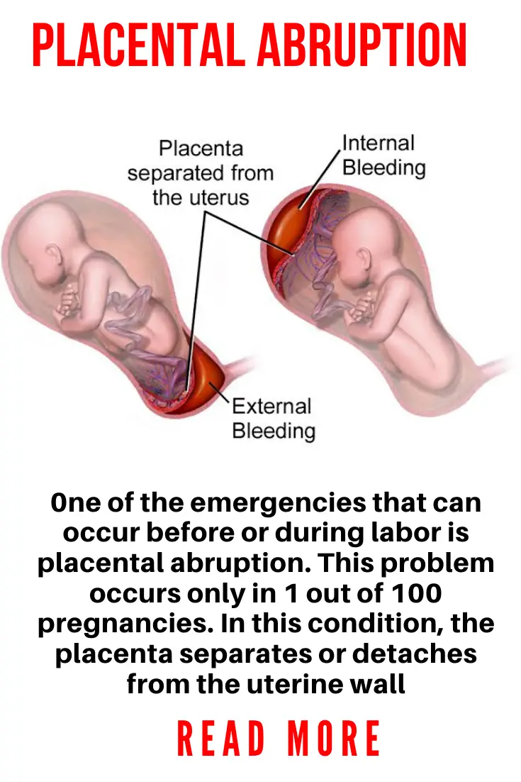 Pictures Of Spotting During Pregnancy 2Nd Trimester / Differential ...