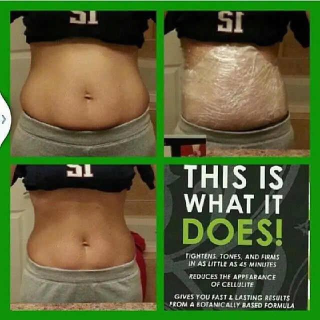 Pin on Tummy Before &  After Pictures