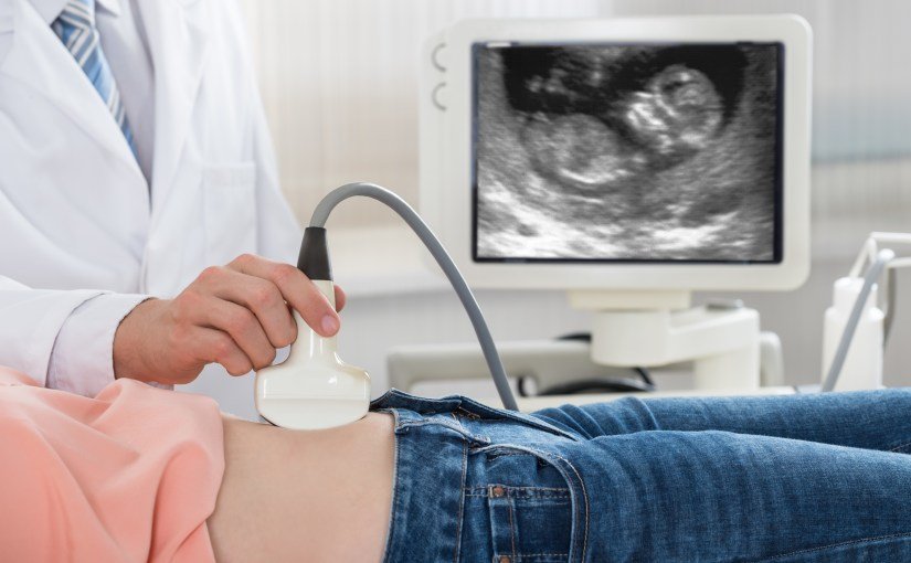 Prenatal Testing: Download my ebook (free)!  Expecting ...