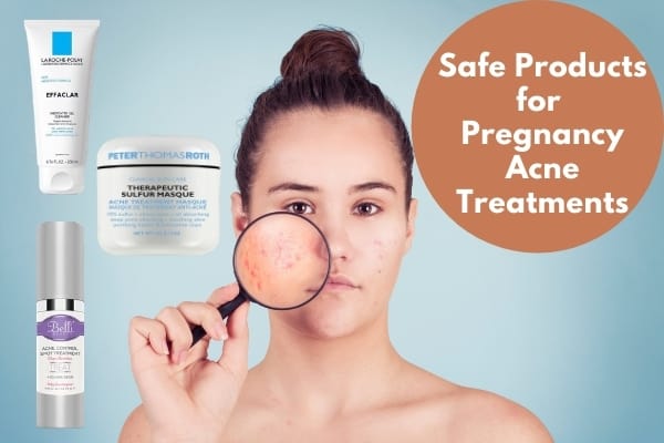 Safe Acne Treatment During Pregnancy